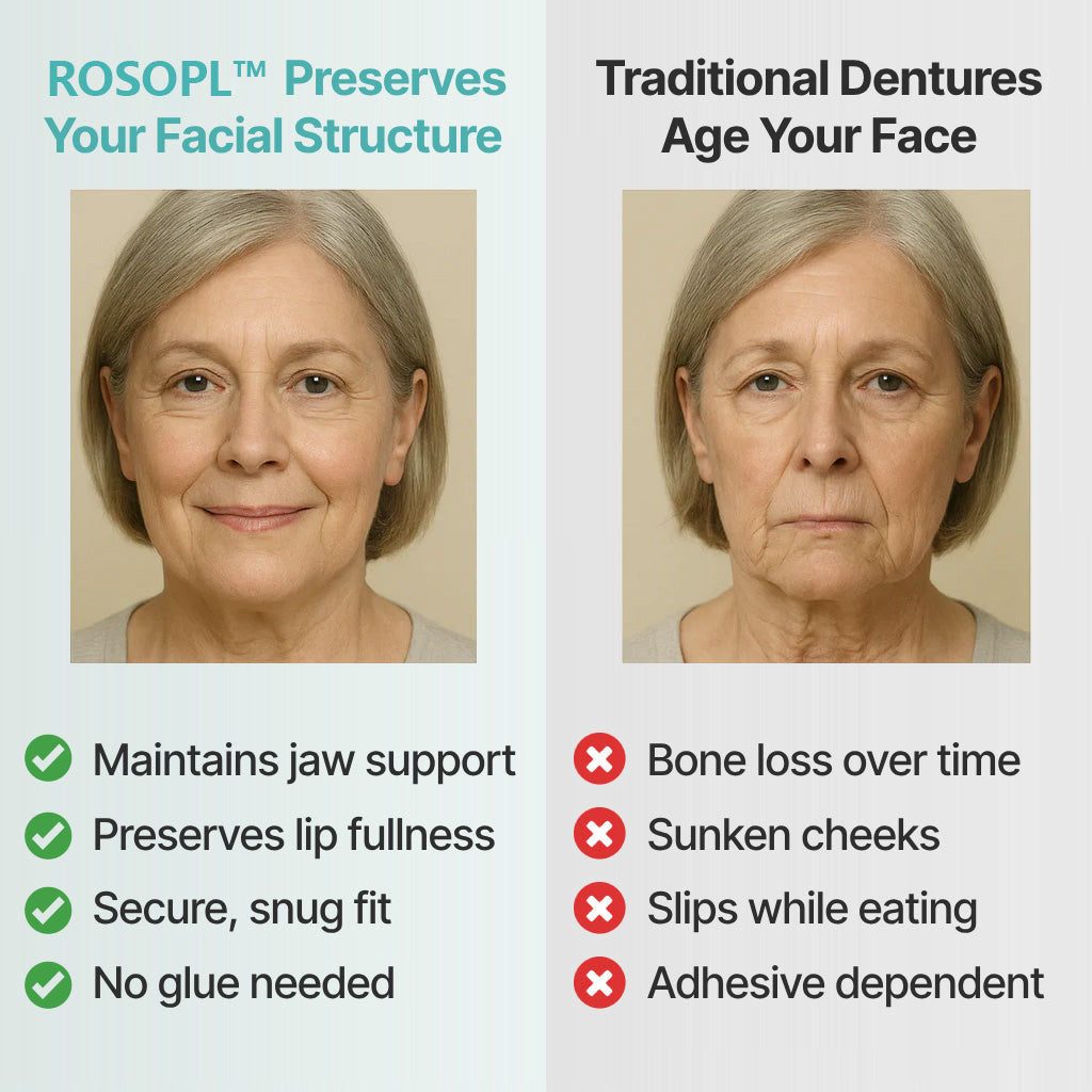 🦷Ends Today: 70% OFF! ROSOPLTM Custom-Fit Full Functional DenturesMake you more confident